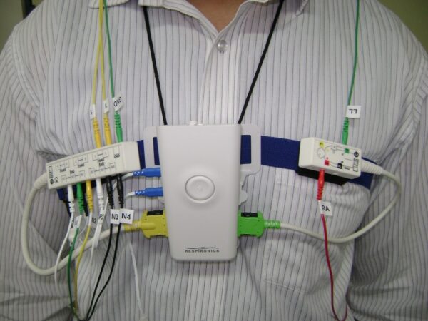 Alice PDX Portable Sleep Diagnostics by Philips - Image 4